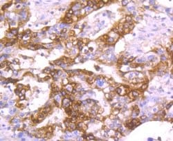 TFF1/pS2 Antibody (JM37-86), Novus Biologicals 100 &mu;l; Unconjugated:Antibodies,